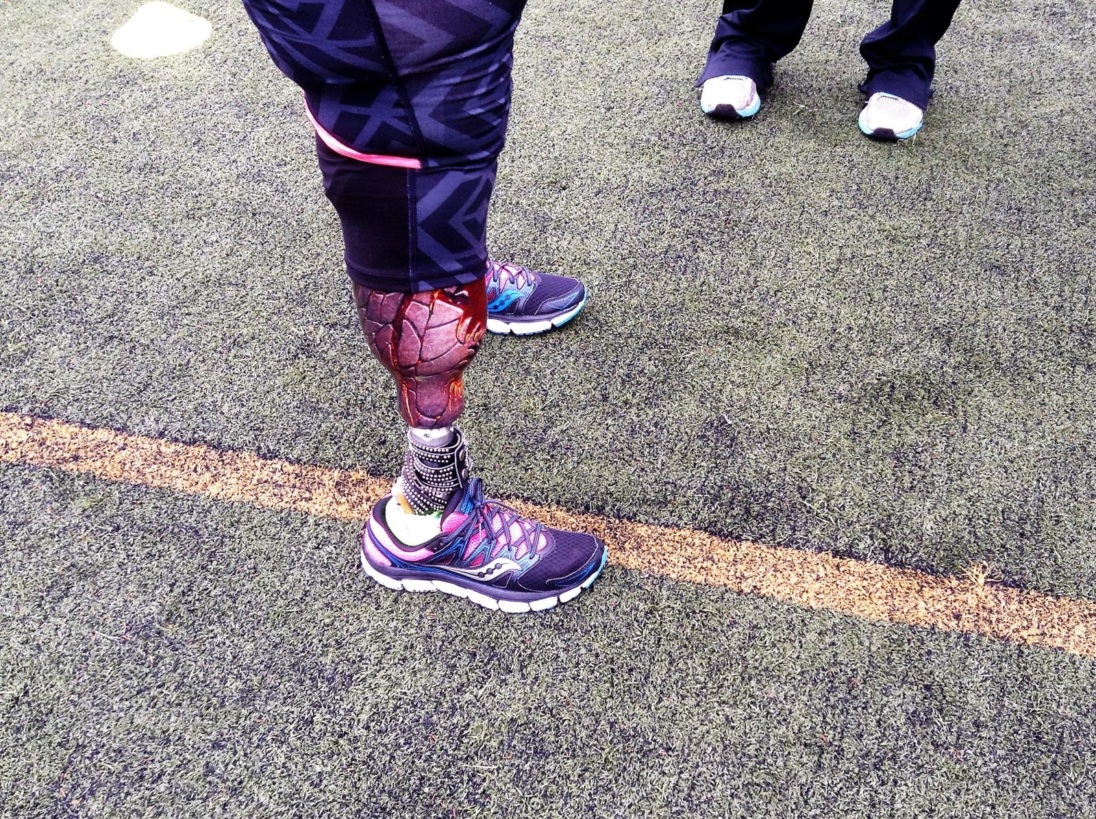 This Is A Photo Of A Custom Prosthetic Limb.