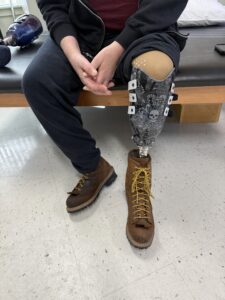 Prosthetic with adjustable heel height of up to 2.75 inches.